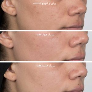 تونر نیاسین امید استلین روشن کننده و ضدلک